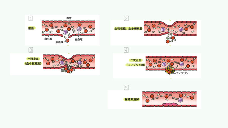【オペナースが知っておくべき】オペで使う止血剤 - 手術室看護師いもてぃブログ~目指せ独り立ち~